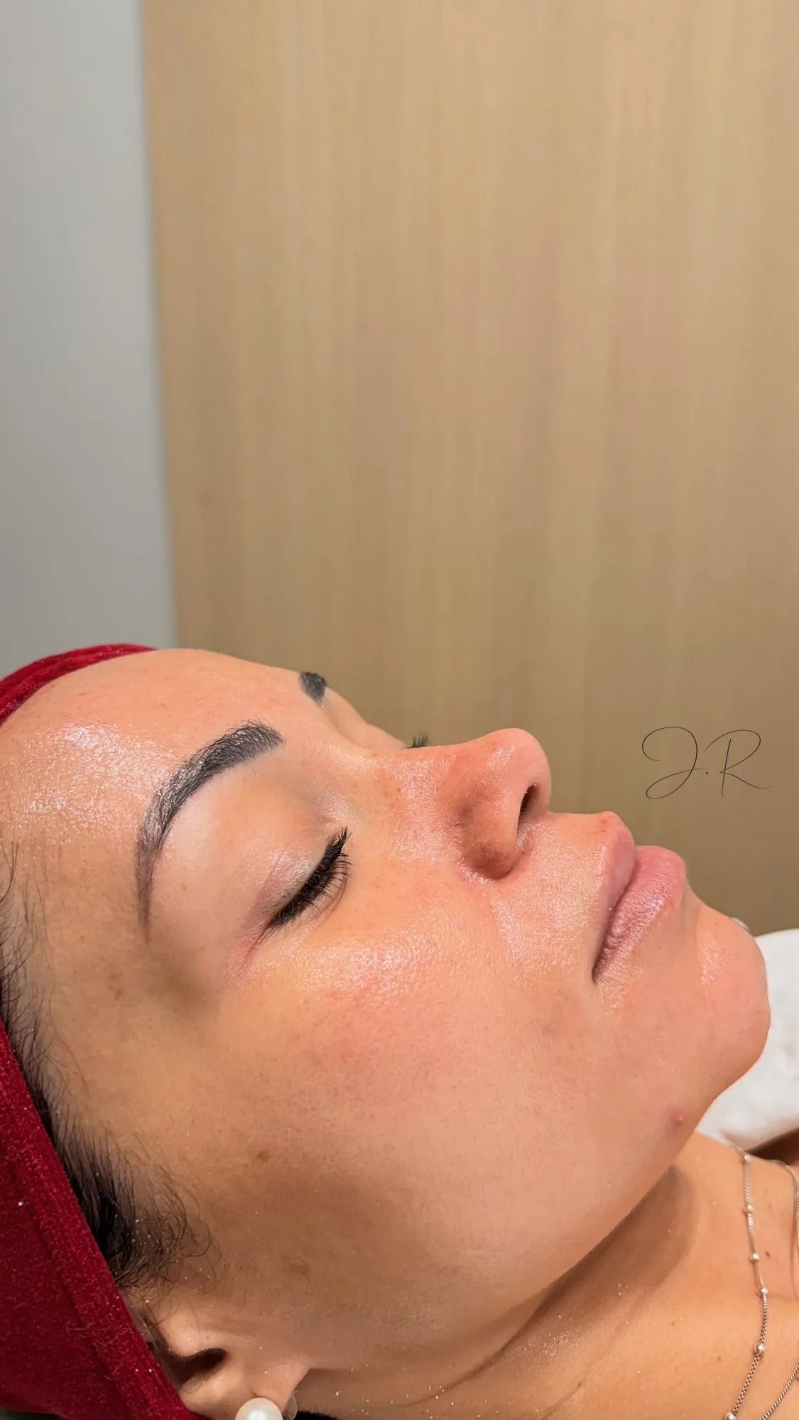 Peeling coreano LHA LA PEEL, perfil do rosto reclinado